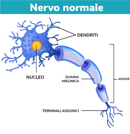 Nervo con mielina sana